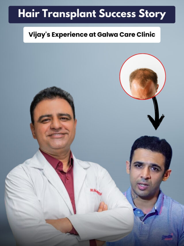 Hair Transplant
